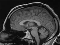 An fMRI scan reveals the changes in brain activity as a pursuer closes in.