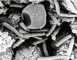 The anthrax bacterium - a potent bioweapon. 