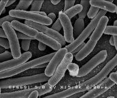 The microbiota, the bacteria that colonise our guts