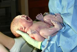 Childbirth can be a difficult experience, not least for a baby's brain