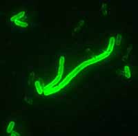 Yersinia pestis causes bubonic plague.