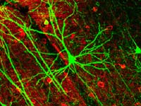 Lost memories can be recovered by encouraging surviving neurons to re-wire themselves.